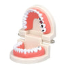 Dental Study Teaching Teeth Model Rotten Tooth Decay Caries Care Dentist Equipment Denture