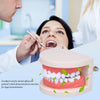 Dental Study Teaching Teeth Model Rotten Tooth Decay Caries Care Dentist Equipment Denture