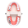Dental Study Teaching Teeth Model Rotten Tooth Decay Caries Care Dentist Equipment Denture