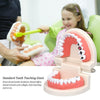 Dental Study Teaching Teeth Model Rotten Tooth Decay Caries Care Dentist Equipment Denture