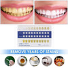 Veemoon 20pcs Tooth Shade Guide PVC Frosted Long Strip Teeth Contrast Cards Oral Supplies Dental Equipment for Professional and Household Use