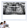 X Ray LED Film Viewer, Wall Mounting X-Ray Film Illuminator Light Box, Dental Illuminator Box Portable, Adjustable Brightness, Flicker-Free, No Shadows, for Lab Equipment (Remote Dimming)