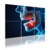 6 Pack Art Acoustic Panels Dental Health Dentist equipment clinic desk Decorative Sound Absorbing Wall Panels 72"x48" Noise Canceling Soundproof Padding Hospital Decor Clinic