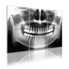 6 Pack Art Acoustic Panels Dental Health Dentist equipment clinic desk Decorative Sound Absorbing Wall Panels 72"x48" Noise Canceling Soundproof Padding Hospital Decor Clinic