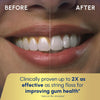 Waterpik Aquarius Water Flosser For Teeth Cleaning, Gums, Braces, Dental Care, Electric Power With 10 Settings, 7 Tips For Multiple Users And Needs, ADA Accepted, White WP-660, Packaging May Vary